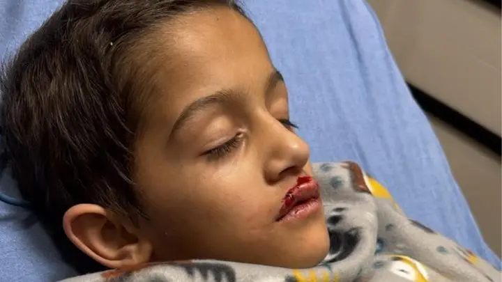 Drones Crash At Orlando